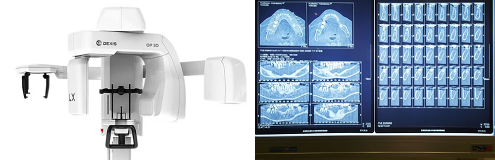 歯科用CT