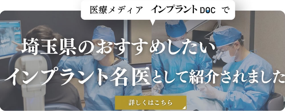インプラントDOC