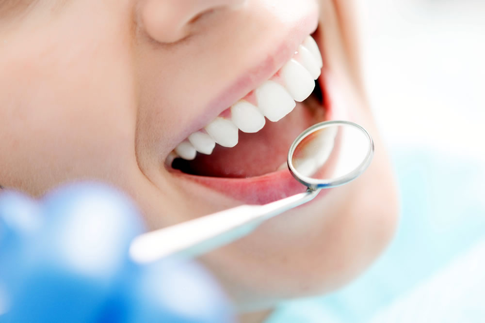 虫歯や歯周病の再治療を防ぐ