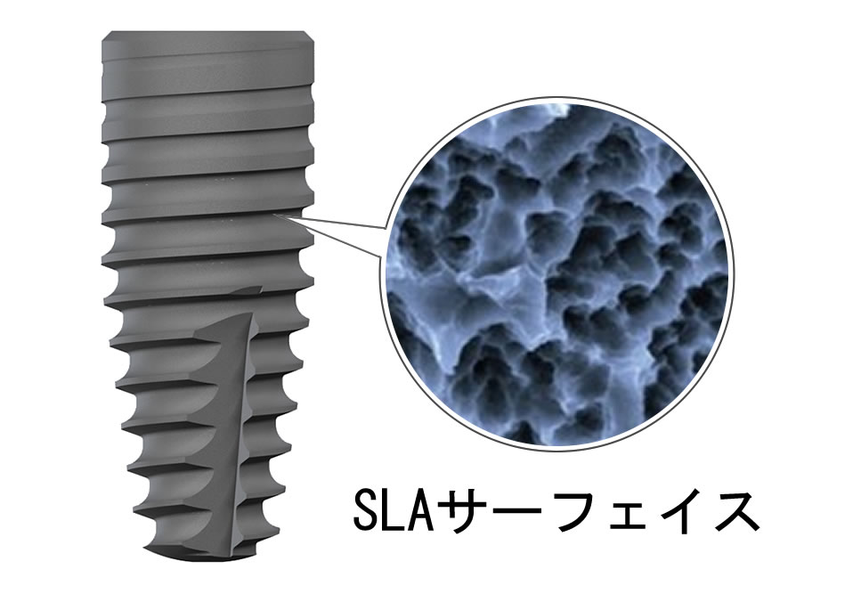 SLA®サーフェイス