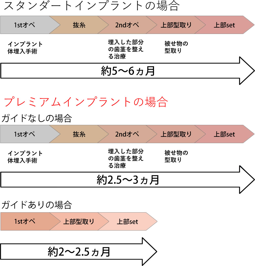 スタンダードインプラントとプレミアムインプラントの治療期間