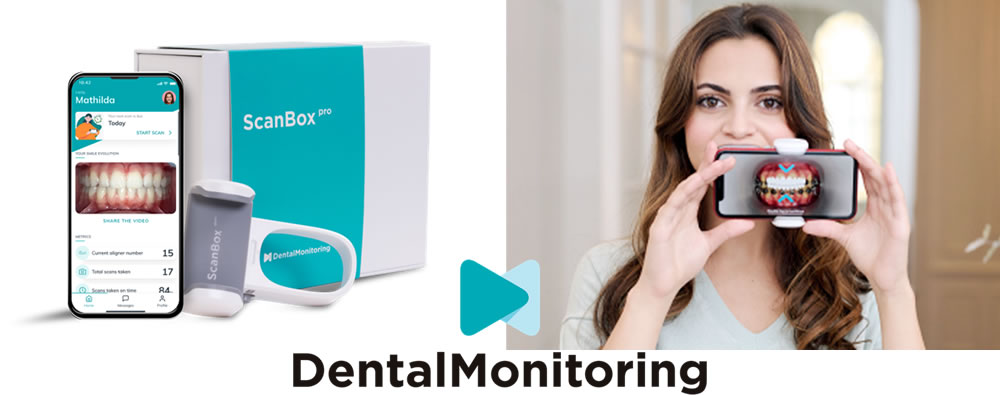 デンタルモニタリング