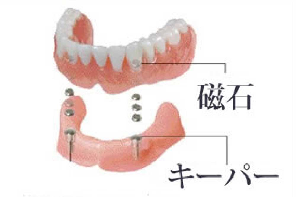 アタッチメント各種
